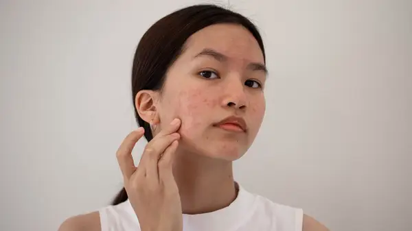 Woman touching her face