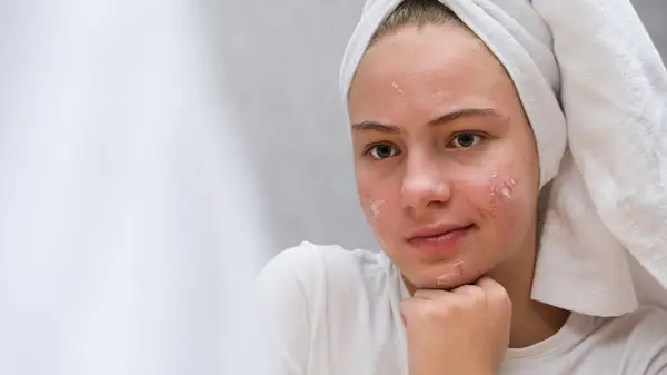 Woman with blemishes, hair wrapped up