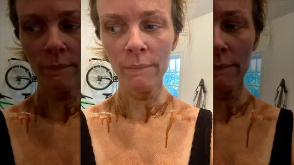 Brooklyn Decker with dripping fake tan on her shoulders