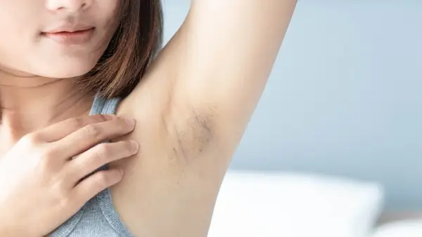 Woman shows her underarm
