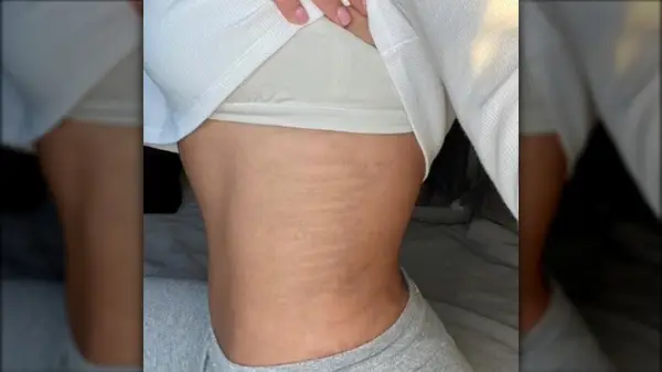 Faded tattoo on side of chest