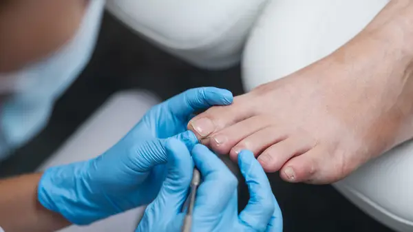 Medical pedicure with latex gloves
