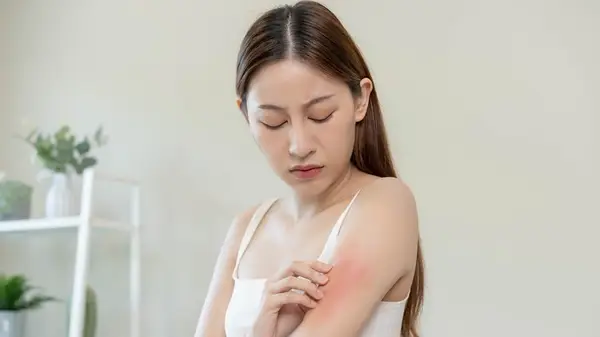 Woman scratching arm