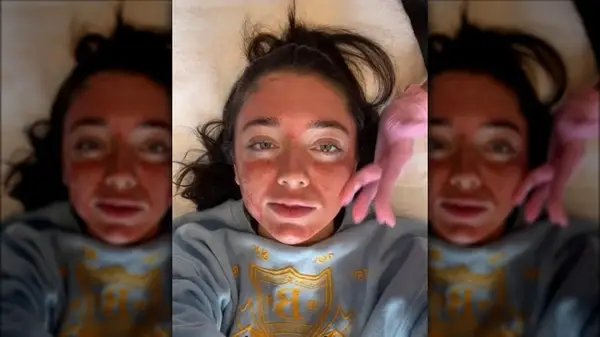 Woman getting a Vampire Facial