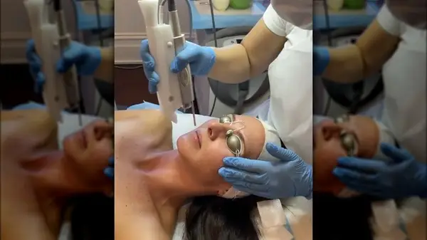 Woman getting Frac3 treatment