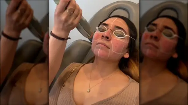 Woman getting Laser Genesis treatment