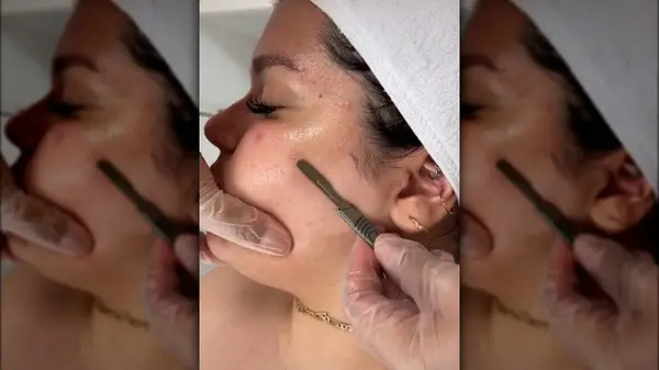 Women getting a Dermaplaning facial