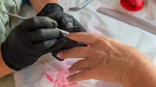 큐티클 리무버는 무엇입니까?