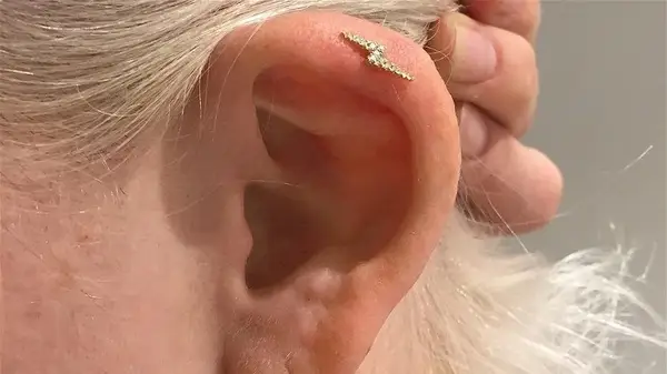 An ear piercing