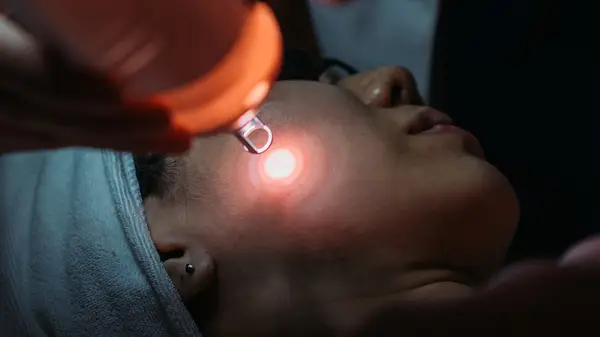 Getting laser facial