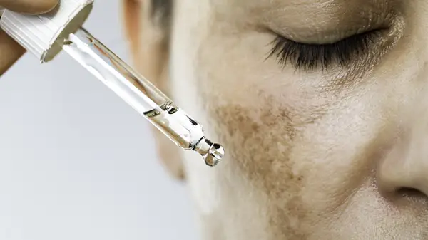 Woman with dark spots adding oil