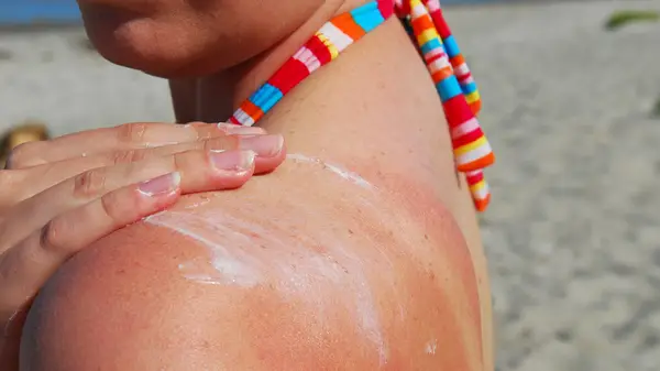 woman applying SPF at beach