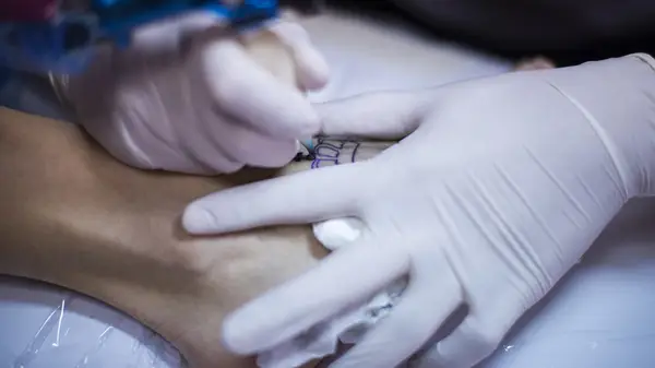 Enskilda tatueringar får popularitet - men de kommer med en varning