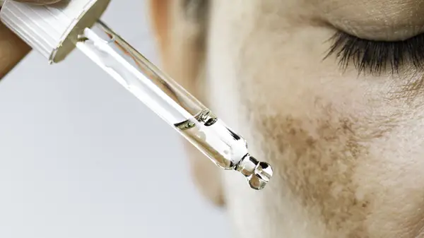 Woman with melasma applying oil to face