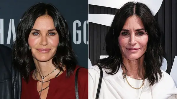 Courteney Cox during and after fillers, side by side