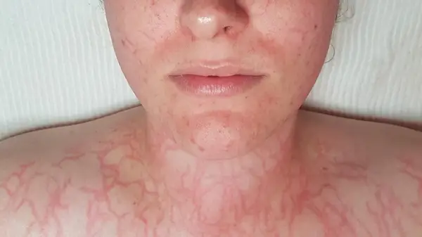 The Plasmatic Effect