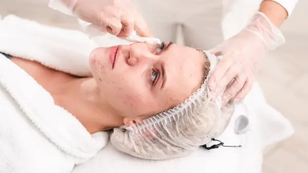 ゾンビフェイシャルはあなたの肌を復活させる野生の治療法です