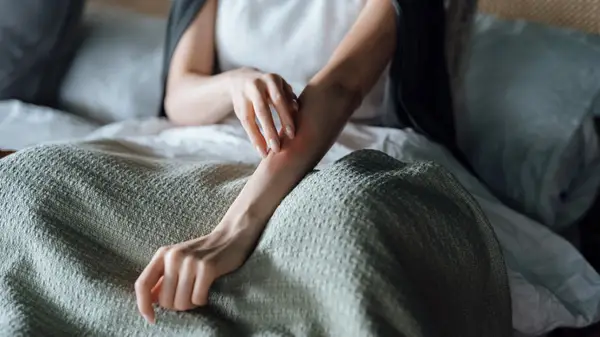 Woman with psoriasis