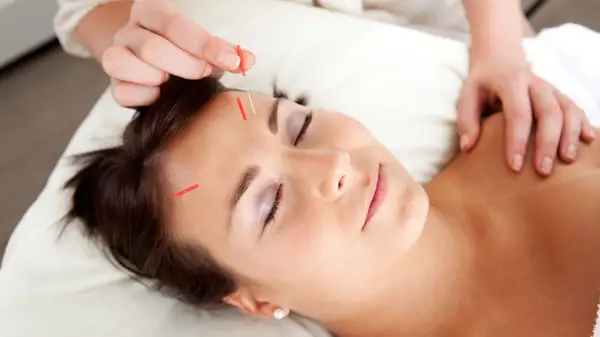 Come l'agopuntura facciale può trasformare la pelle