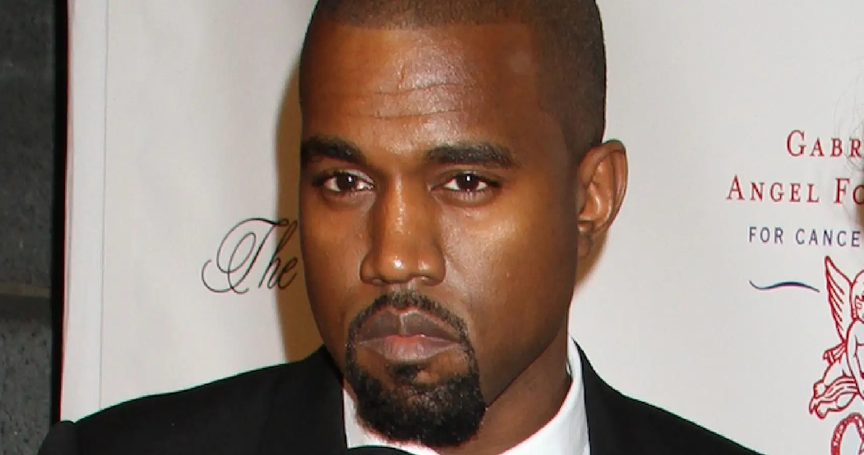 Kanye West está arriesgando su salud con dientes de titanio de 850.000 dólares a pesar del rumoreado embarazo de Bianca