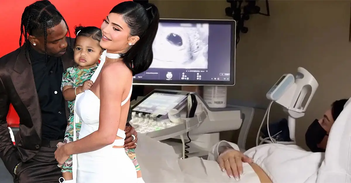 Kylie Jenner w białej sukience trzymająca Stormi, obok Travisa Scotta w brązowym garniturze (po lewej) Kylie Jenner w szpitalnym łóżku podczas badania USG dziecka (po prawej)