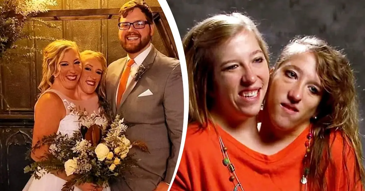 Brittany i Abby Hensel marit