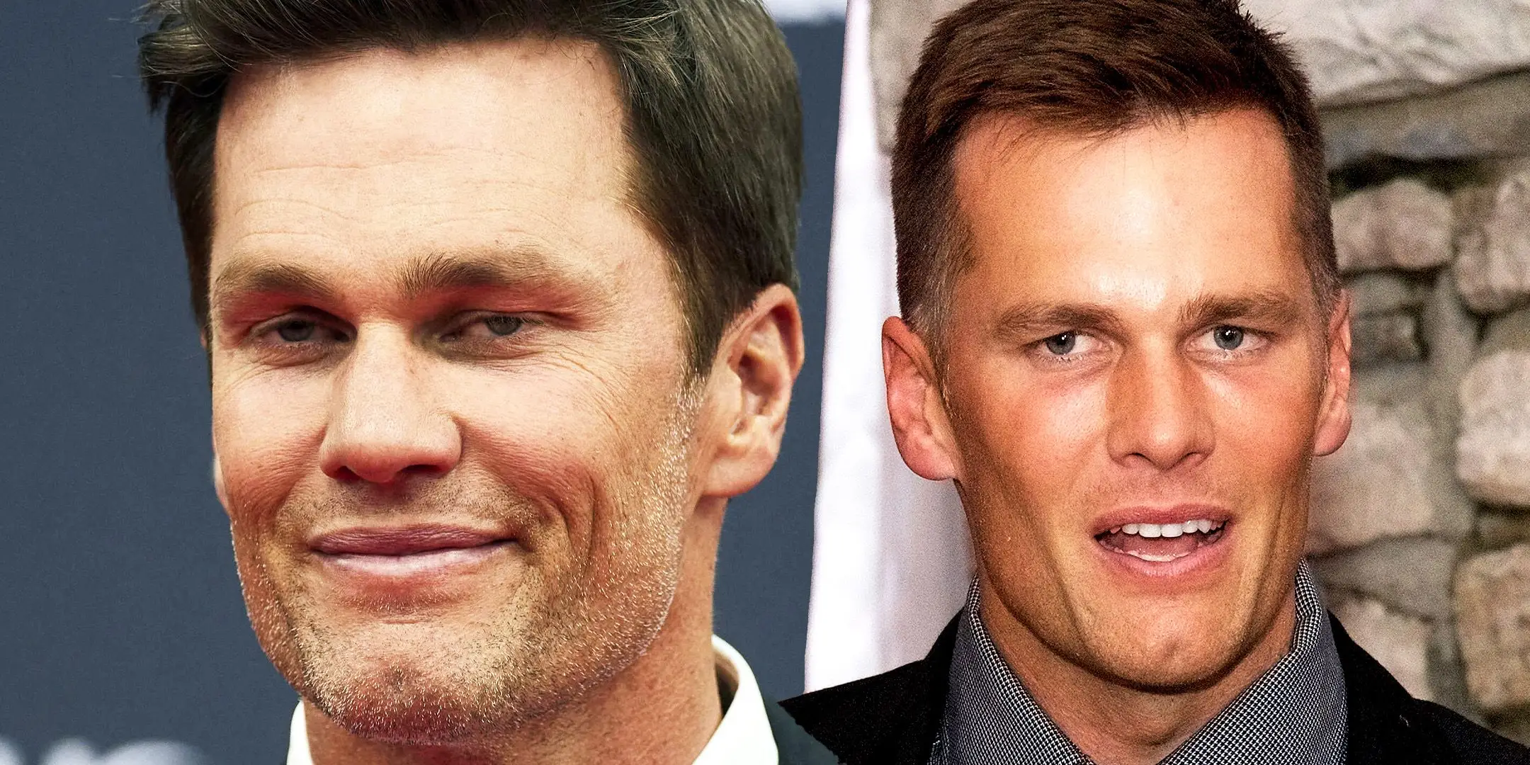 Rumors de cirurgia plàstica de Tom Brady