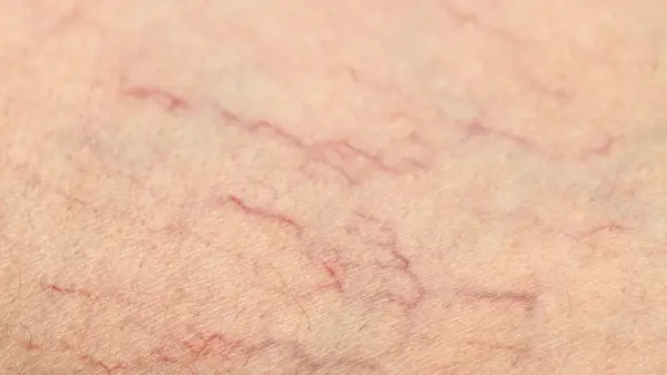 Person reclining in seat, legs crossed