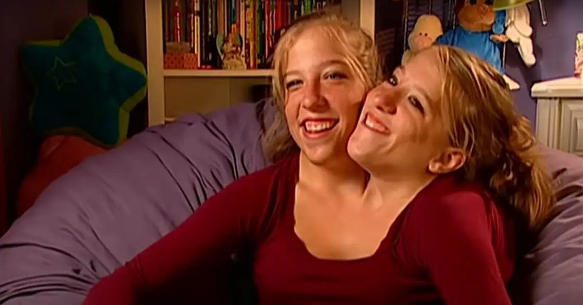 Abby e Brittany Hensel sorridono