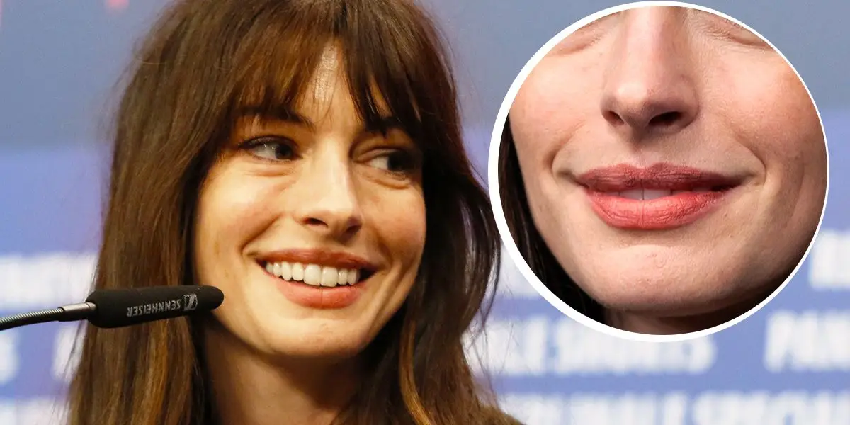 Anne Hathaway krediterar hennes imperfekta näsa