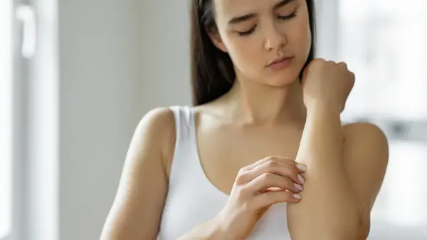 Woman scratching arm